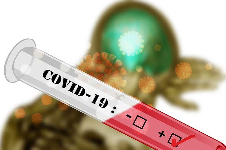 Всё, что вы хотели знать об антителах к COVID-19 и тестах на их наличие