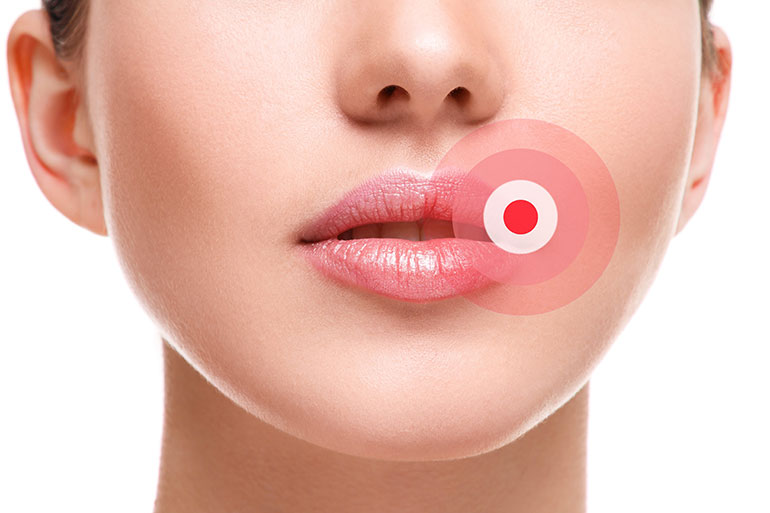Как увлажнить сухую кожу губ - статьи многопрофильной клиники «Дезир»